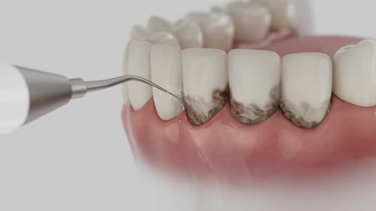 Reliable Dental contractor in Port Barrington, IL by Dentist Open Now